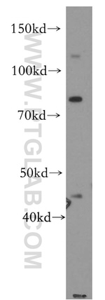 MTUS1 Antibody in Western Blot (WB)