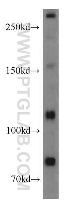 MTUS1 Antibody in Western Blot (WB)