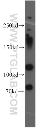 MTUS1 Antibody in Western Blot (WB)