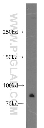 MTUS1 Antibody in Western Blot (WB)