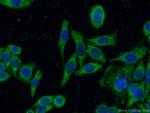 NNT Antibody in Immunocytochemistry (ICC/IF)