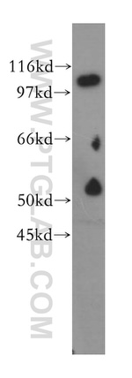 NNT Antibody in Western Blot (WB)