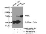 KCNS2 Antibody in Immunoprecipitation (IP)