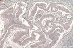 DVL3 Antibody in Immunohistochemistry (Paraffin) (IHC (P))