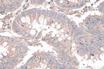 DVL3 Antibody in Immunohistochemistry (Paraffin) (IHC (P))