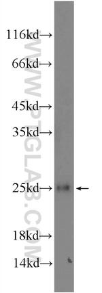 GCET2 Antibody in Western Blot (WB)