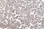 PDGFRB Antibody in Immunohistochemistry (Paraffin) (IHC (P))