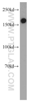 PDGFRB Antibody in Western Blot (WB)