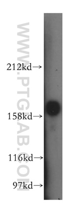 PDGFRB Antibody in Western Blot (WB)