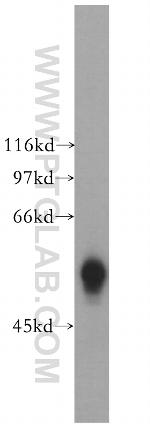 GK5 Antibody in Western Blot (WB)