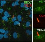 BBS7 Antibody in Immunocytochemistry (ICC/IF)