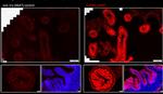 IL22RA1 Antibody in Immunocytochemistry (ICC/IF)