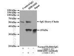 HIBADH Antibody in Immunoprecipitation (IP)