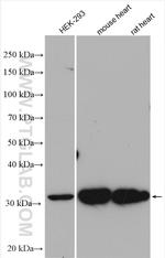 HIBADH Antibody in Western Blot (WB)