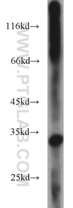 HIBADH Antibody in Western Blot (WB)