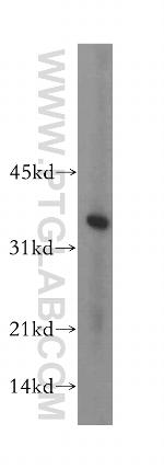 HIBADH Antibody in Western Blot (WB)