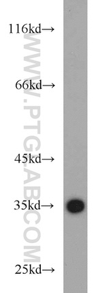 HIBADH Antibody in Western Blot (WB)