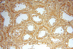 VASP Antibody in Immunohistochemistry (Paraffin) (IHC (P))