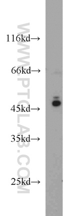 VASP Antibody in Western Blot (WB)