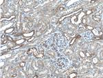 SYVN1 Antibody in Immunohistochemistry (Paraffin) (IHC (P))