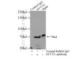 SYVN1 Antibody in Immunoprecipitation (IP)