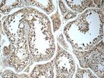 Cryptochrome 1 Antibody in Immunohistochemistry (Paraffin) (IHC (P))