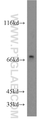 Cryptochrome 1 Antibody in Western Blot (WB)