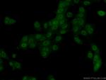 PPP2CA Antibody in Immunocytochemistry (ICC/IF)