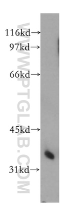 PPP2CA Antibody in Western Blot (WB)