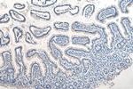 EVL Antibody in Immunohistochemistry (Paraffin) (IHC (P))