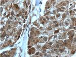 PIAS3 Antibody in Immunohistochemistry (Paraffin) (IHC (P))