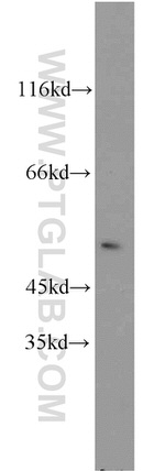 EGR2 Antibody in Western Blot (WB)