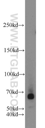 EGR2 Antibody in Western Blot (WB)