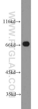 EGR2 Antibody in Western Blot (WB)