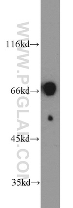 EGR2 Antibody in Western Blot (WB)