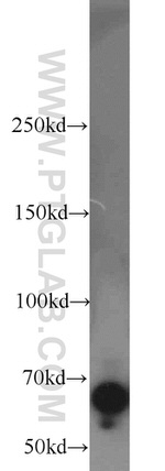 EGR2 Antibody in Western Blot (WB)