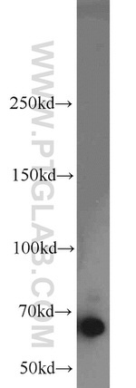 EGR2 Antibody in Western Blot (WB)