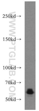 CDH23 Antibody in Western Blot (WB)