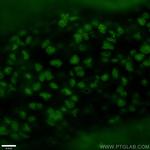 OTX2 Antibody in Immunohistochemistry (PFA fixed) (IHC (PFA))