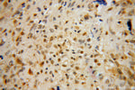 OTX2 Antibody in Immunohistochemistry (Paraffin) (IHC (P))