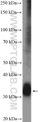OTX2 Antibody in Western Blot (WB)