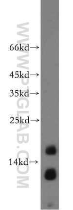 NGB Antibody in Western Blot (WB)