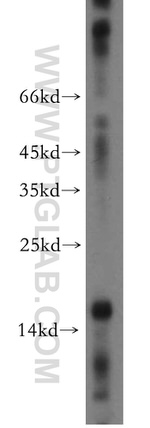 NGB Antibody in Western Blot (WB)