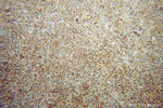 RIAM Antibody in Immunohistochemistry (Paraffin) (IHC (P))