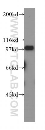 RIAM Antibody in Western Blot (WB)