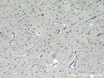 GPX7 Antibody in Immunohistochemistry (Paraffin) (IHC (P))