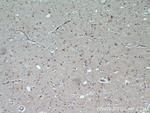 GPX7 Antibody in Immunohistochemistry (Paraffin) (IHC (P))