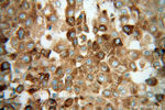 GPX7 Antibody in Immunohistochemistry (Paraffin) (IHC (P))