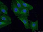 TNNC1 Antibody in Immunocytochemistry (ICC/IF)