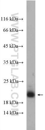 TNNC1 Antibody in Western Blot (WB)